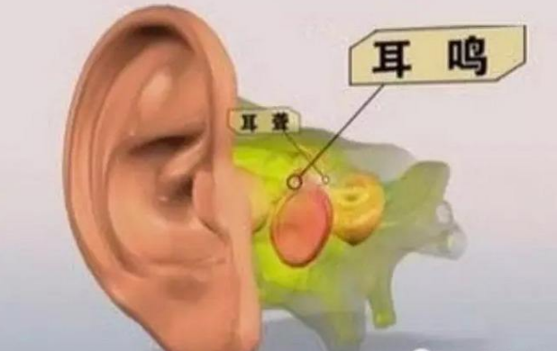 耳聋、耳鸣等耳朵问题使用哪些荣格产品进行调理？
